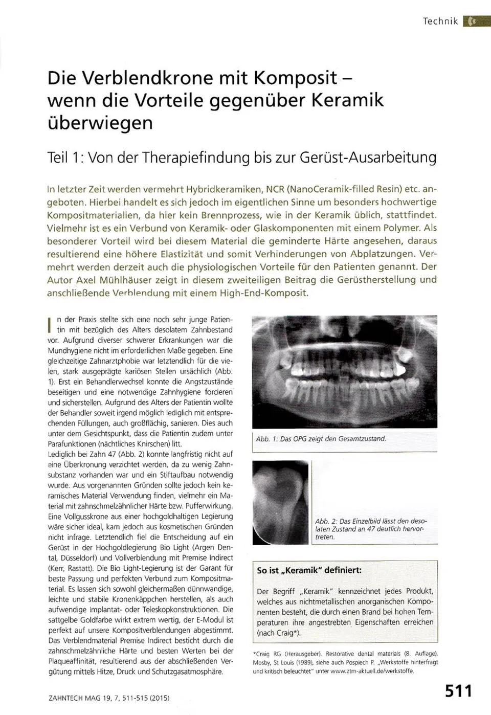 komet-dental-ceracut-fachbericht-verblendkrone-komposit image 1