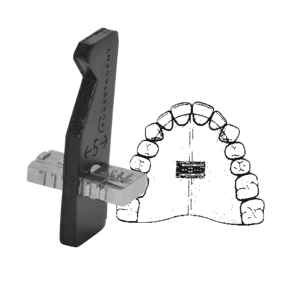 forestadent-memory-dehnschraube-transversal-5-mm-niti-feder image 3
