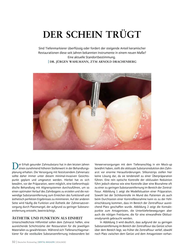 komet-dental-diao-fachbericht-der-schein-tr-gt-prepmarker-keramik image 1