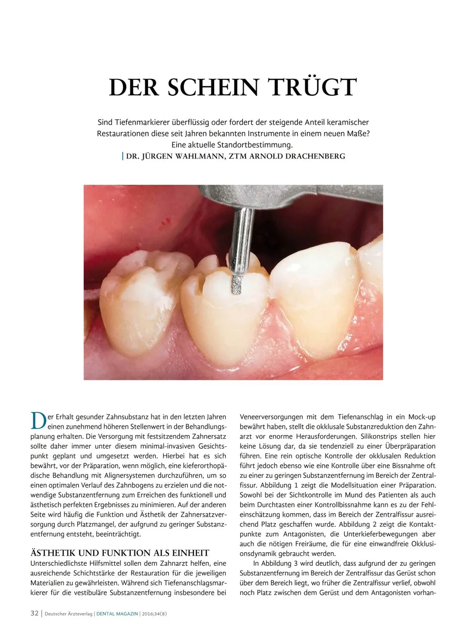 komet-dental-diao-fachbericht-der-schein-tr-gt-prepmarker-keramik image 1