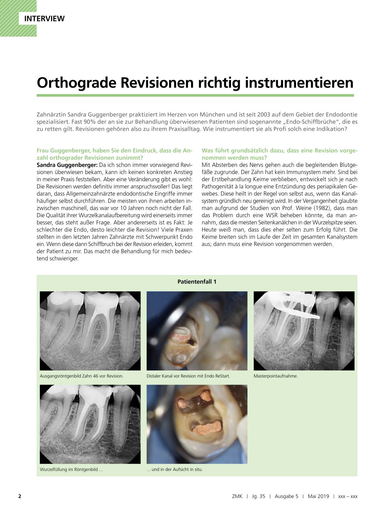komet-fq-fachbericht-orthograde-revision-instrumentierung image 1