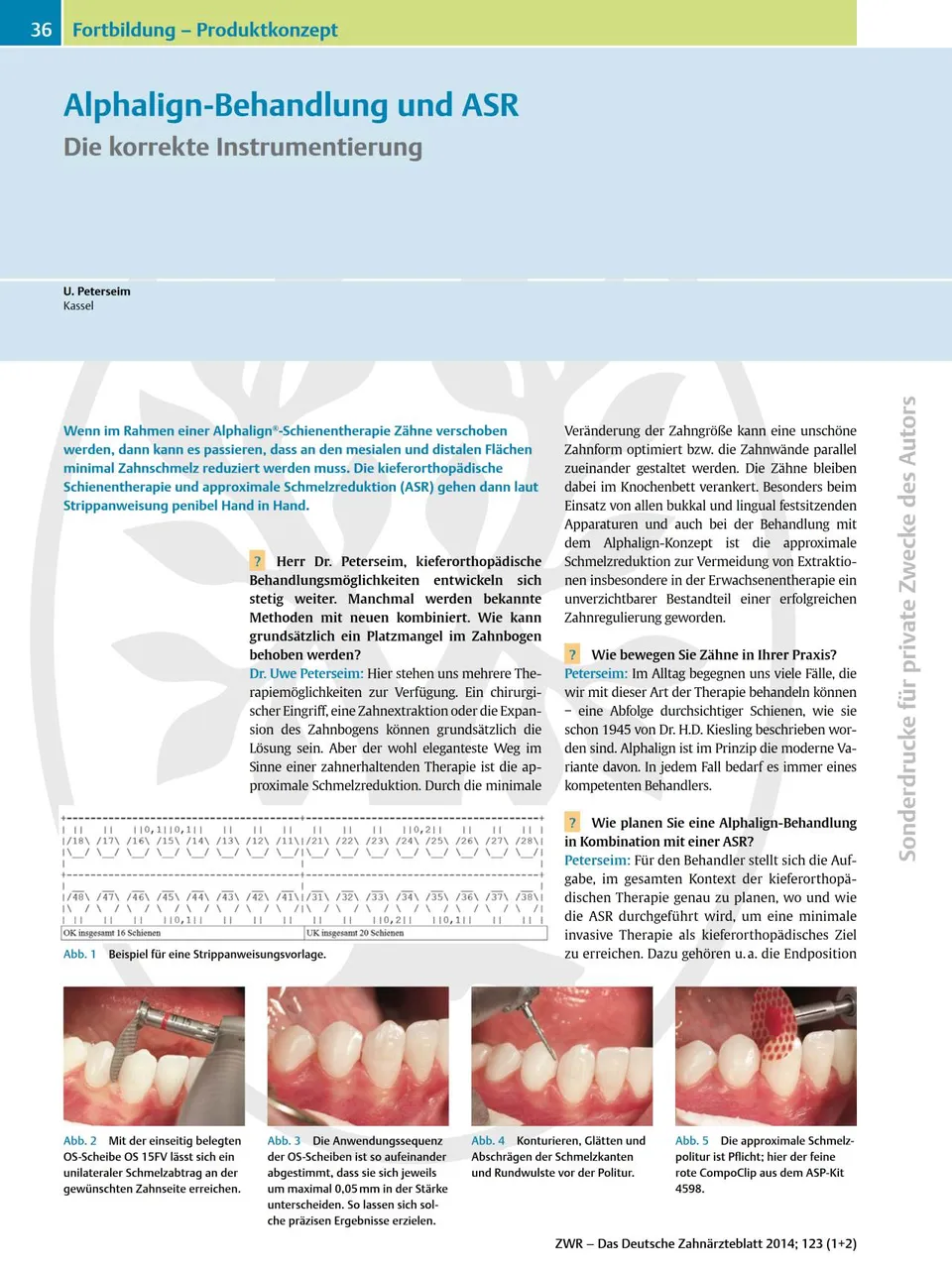 komet-dental-sonicline-fachbericht-alphalign-asr-instrumentierung image 1