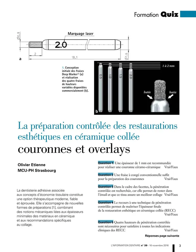 komet-dental-diao-pr-paration-restaurationen-fachbericht image 1