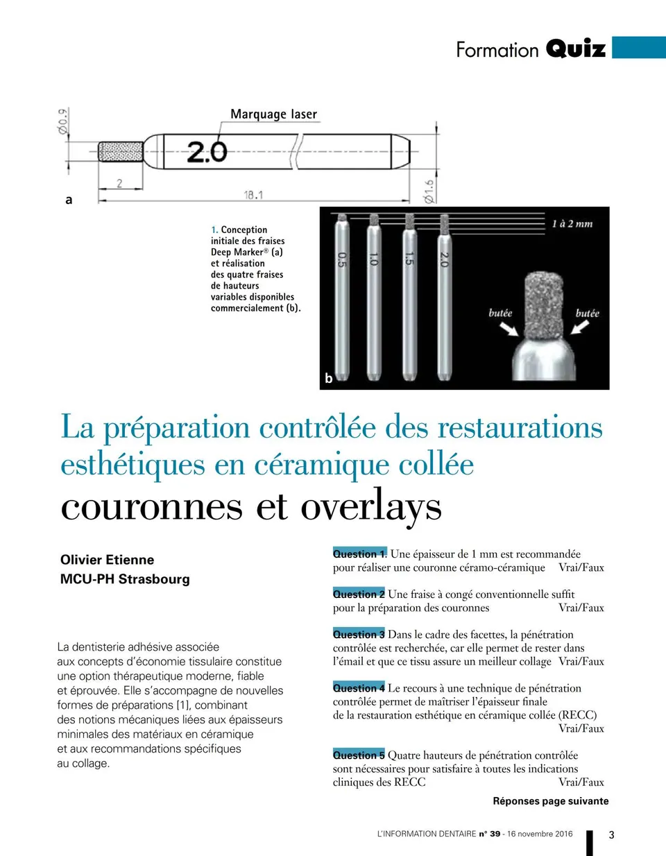 komet-dental-diao-pr-paration-restaurationen-fachbericht image 1