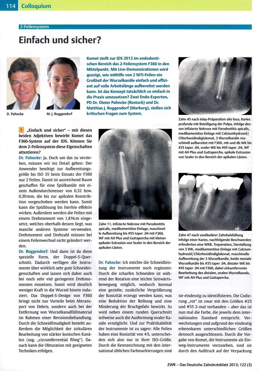 komet-dental-f360-fachbericht-2-feilensystem-endodontie-zwr-2013 image 1