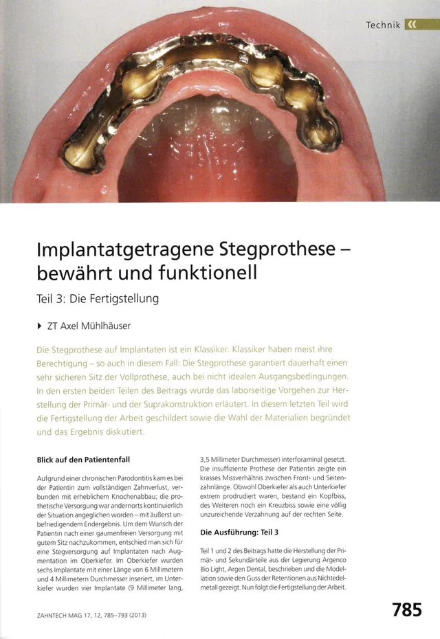 komet-shax-fr-ser-stegprothese-implantat image 1