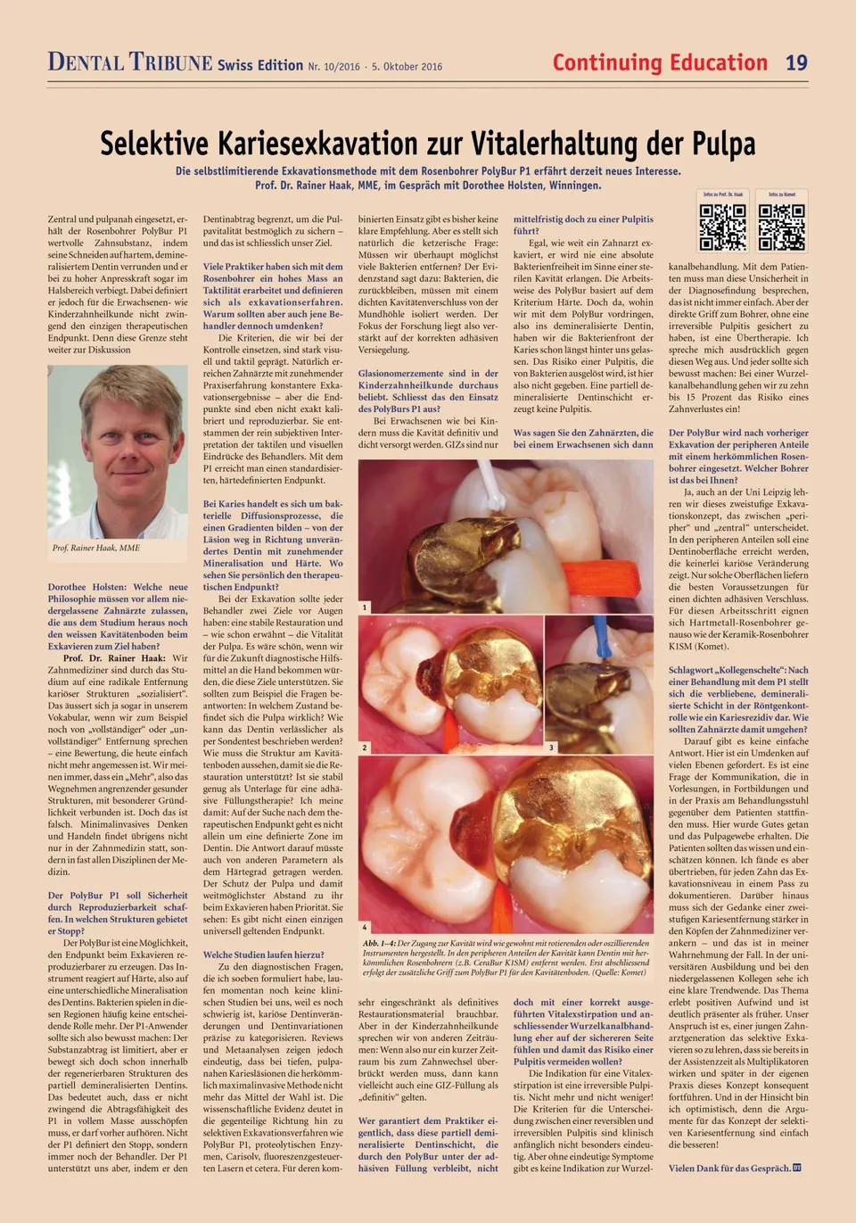 komet-diao-p1-fachbericht-selektive-kariesexkavation image 1