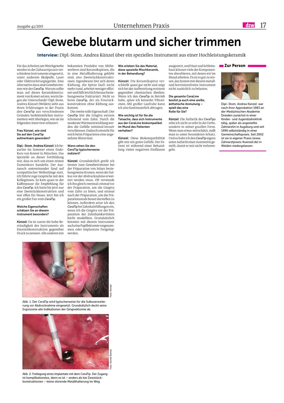 komet-ceratip-gewebetrimmer-bericht-keramik image 1