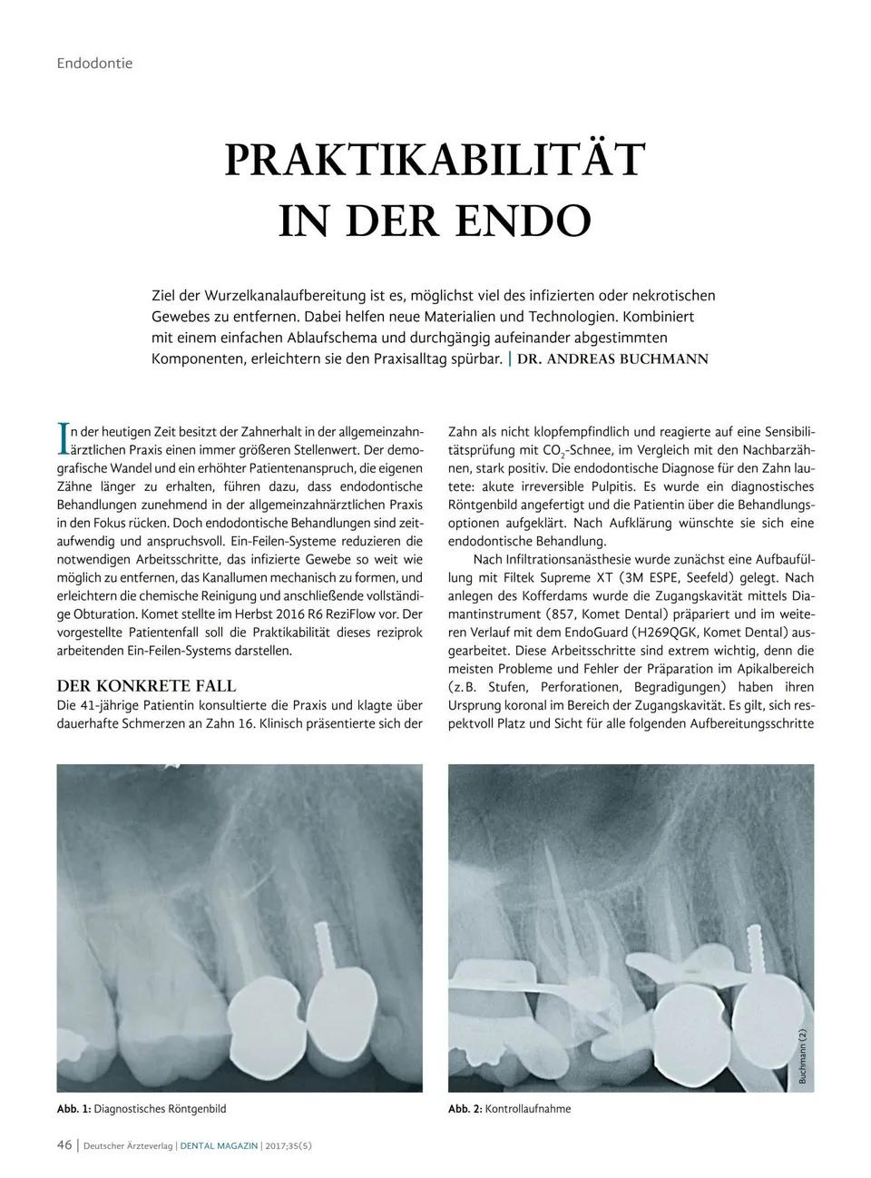 komet-fq-endo-fachbericht-wurzelkanalaufbereitung-06-2017 image 1