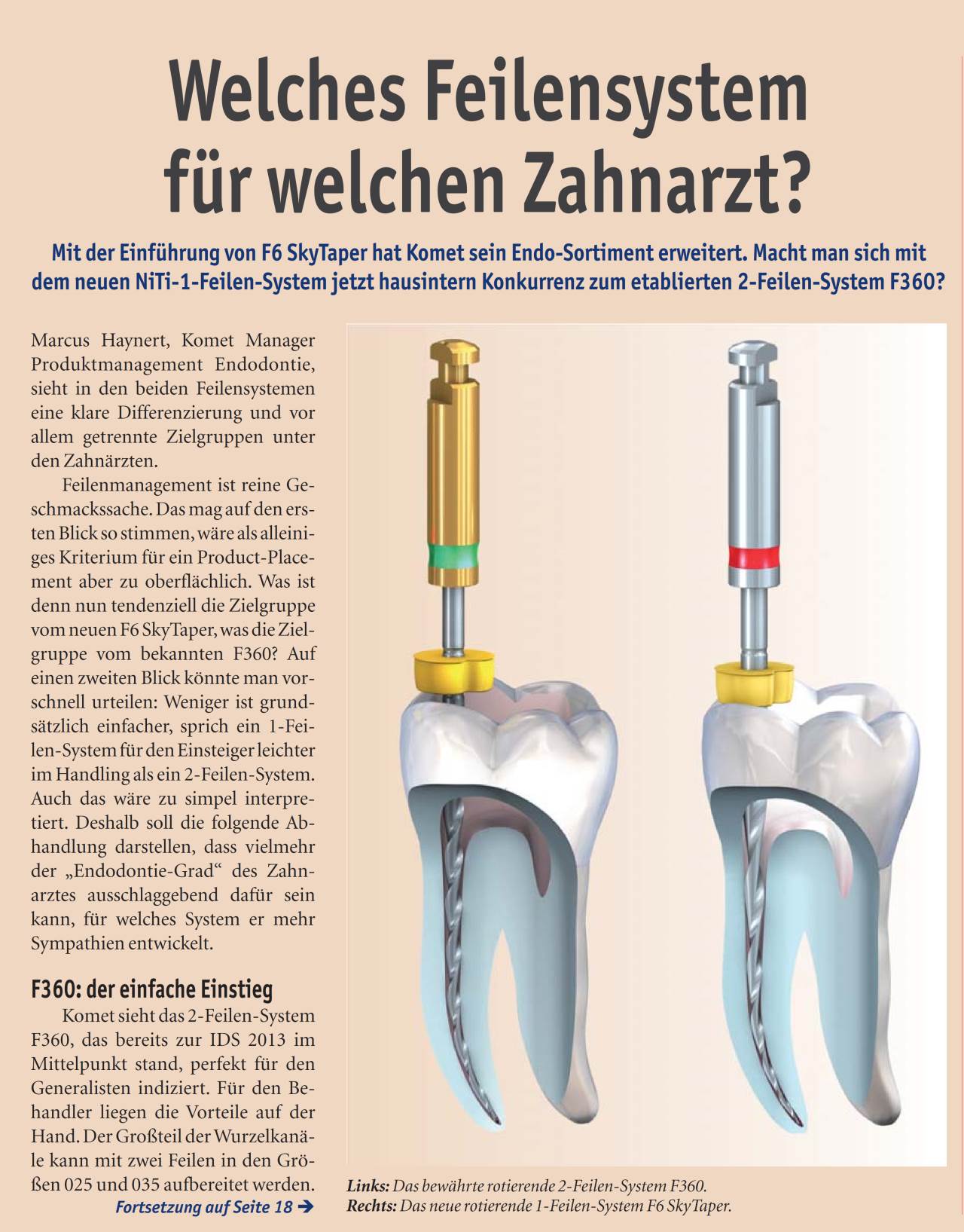 komet-fq-f6-skytaper-f360-niti-feilen-endo image 1