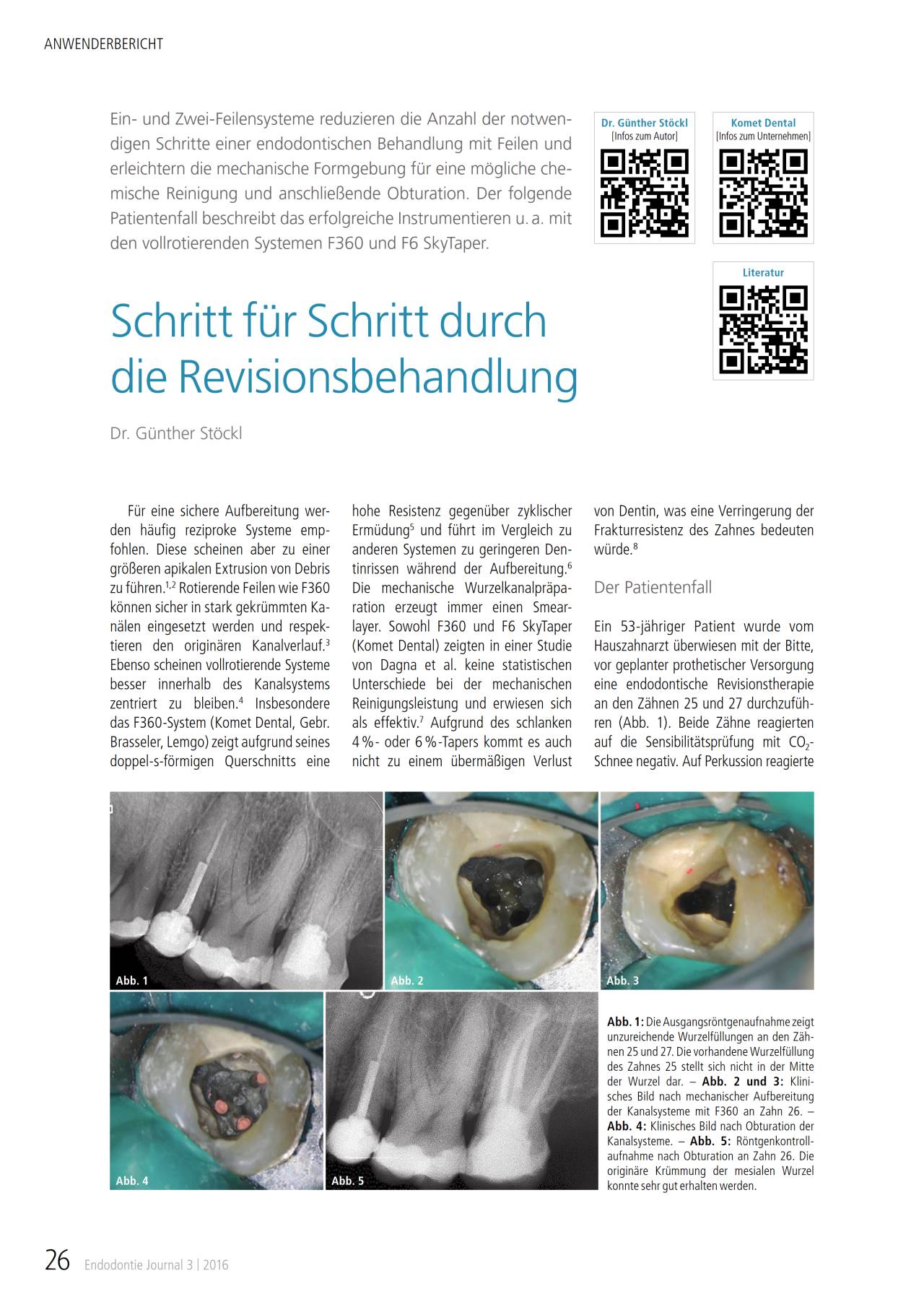 komet-fq-revisionsbehandlung-fachbericht-f360-f6-skytaper image 1