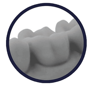 forestadent-uniz-3d-drucker-nbee-ubee-aligner-dental-labor image 7