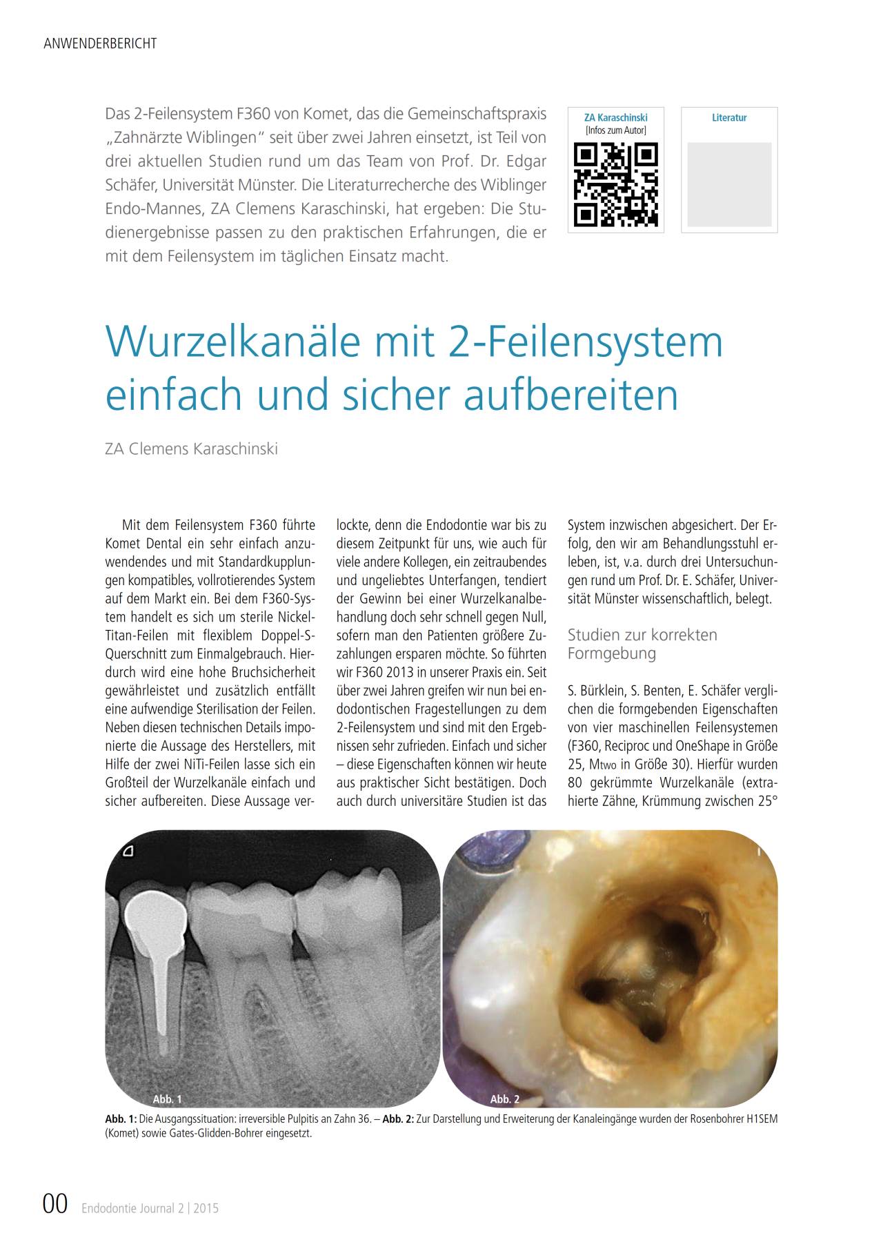 komet-fq-fachbericht-f360-2-feilensystem-aufbereitung image 1