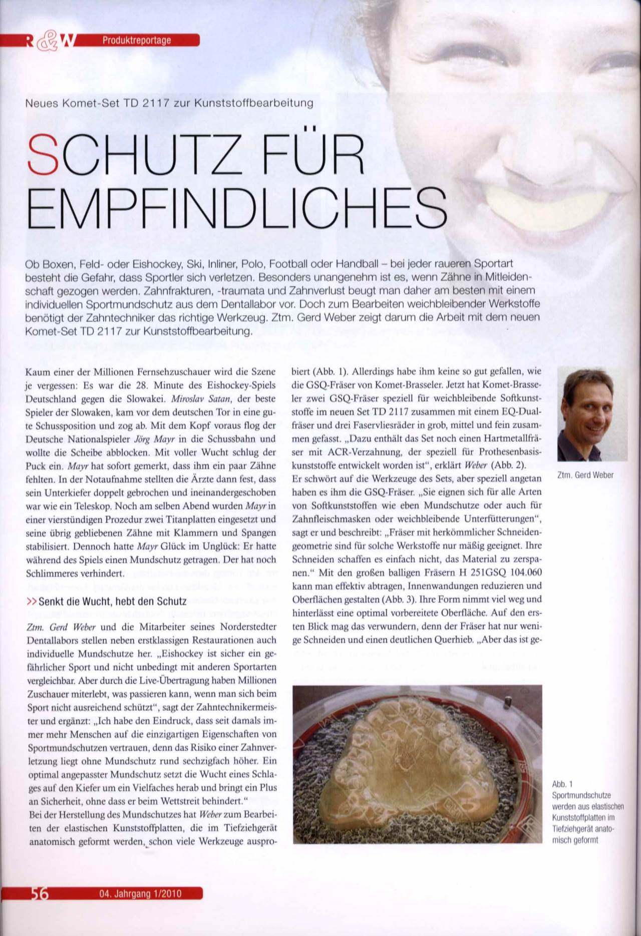 komet-dental-diao-fachbericht-td2117-kunststoffbearbeitung image 1