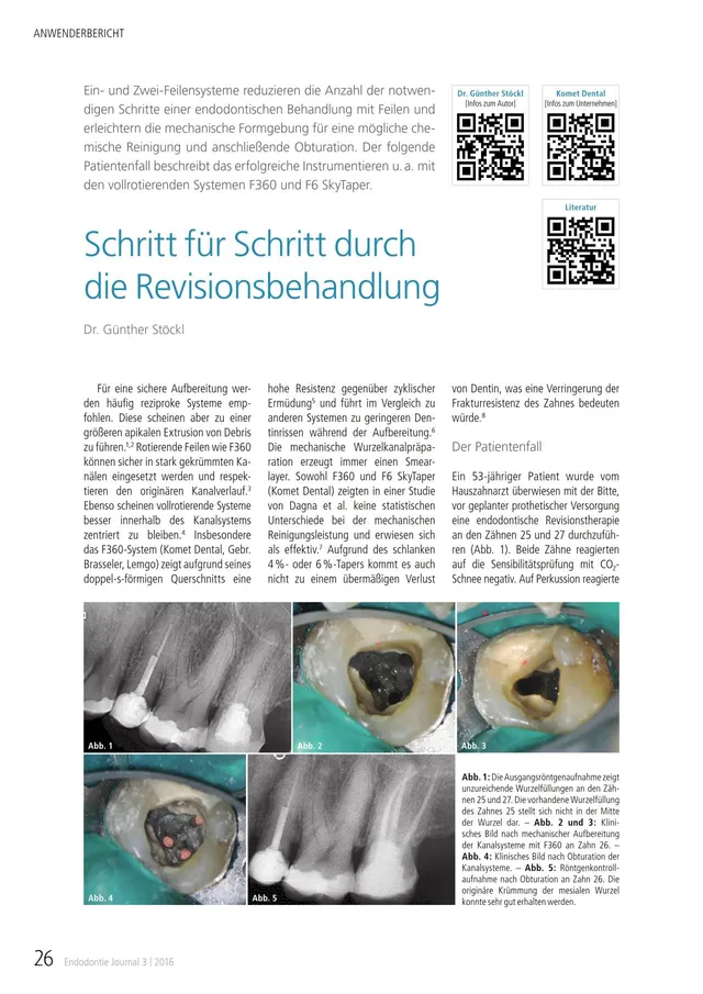 komet-fq-revisionsbehandlung-fachbericht-f360-f6-skytaper image 1