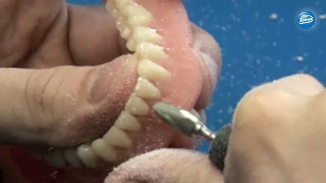 komet-dental-art2-video-vollprothese-polieren-artikulator image 1
