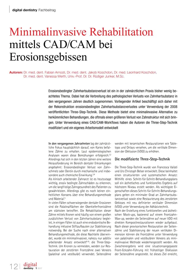 komet-diao-erosionsgebiss-fachbericht-cad-cam image 1