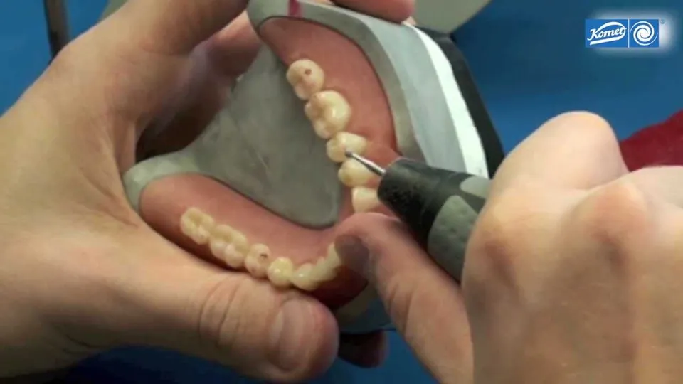 komet-dental-shax-video-kunststoff-prothese-ausarbeitung image 1