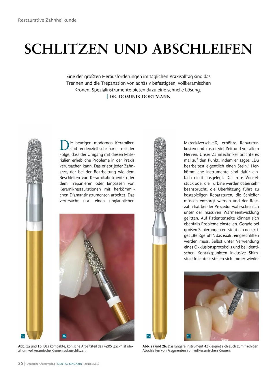 komet-diao-trennschleifer-vollkeramik-kronen-trepanation image 1