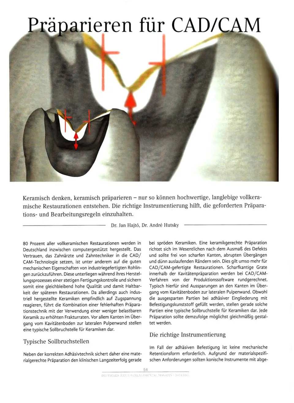 komet-diao-cad-cam-pr-parierset-diamant-keramik image 1
