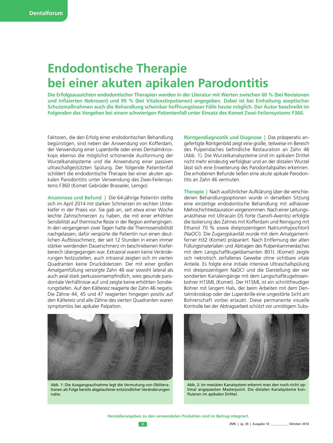 komet-fq-fachbericht-endo-therapie-f360-parodontitis image 1