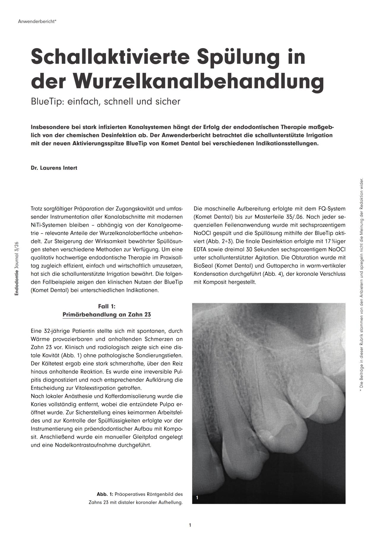 komet-sonicline-fachbericht-schallaktivierte-sp-lung-ej-08-2026 image 1