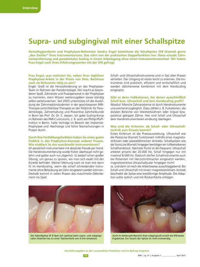 komet-dental-sonicline-fachbericht-schallspitze-prophylaxe image 1