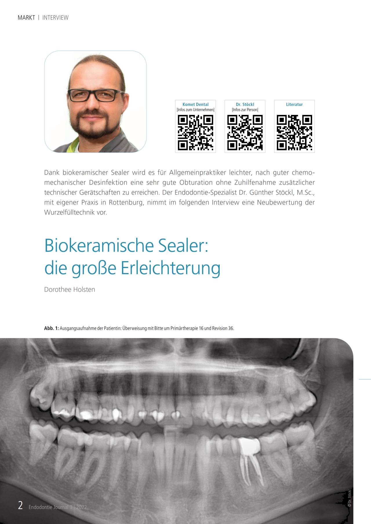 komet-dental-bioseal-fachbericht-biokeramische-sealer-endodontie image 1