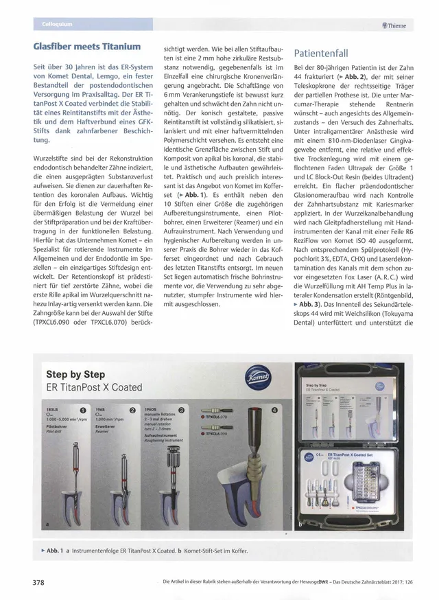 komet-cerapost-glasfiber-titan-stiftaufbau-bericht image 1