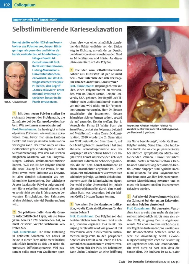 komet-dental-diao-fachbericht-polybur-kariesexkavation image 1