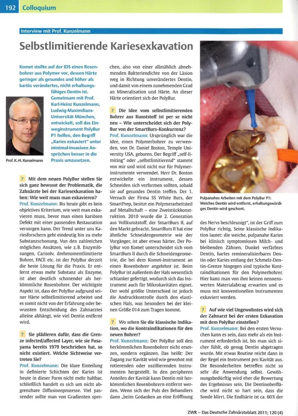 komet-dental-diao-fachbericht-polybur-kariesexkavation image 1