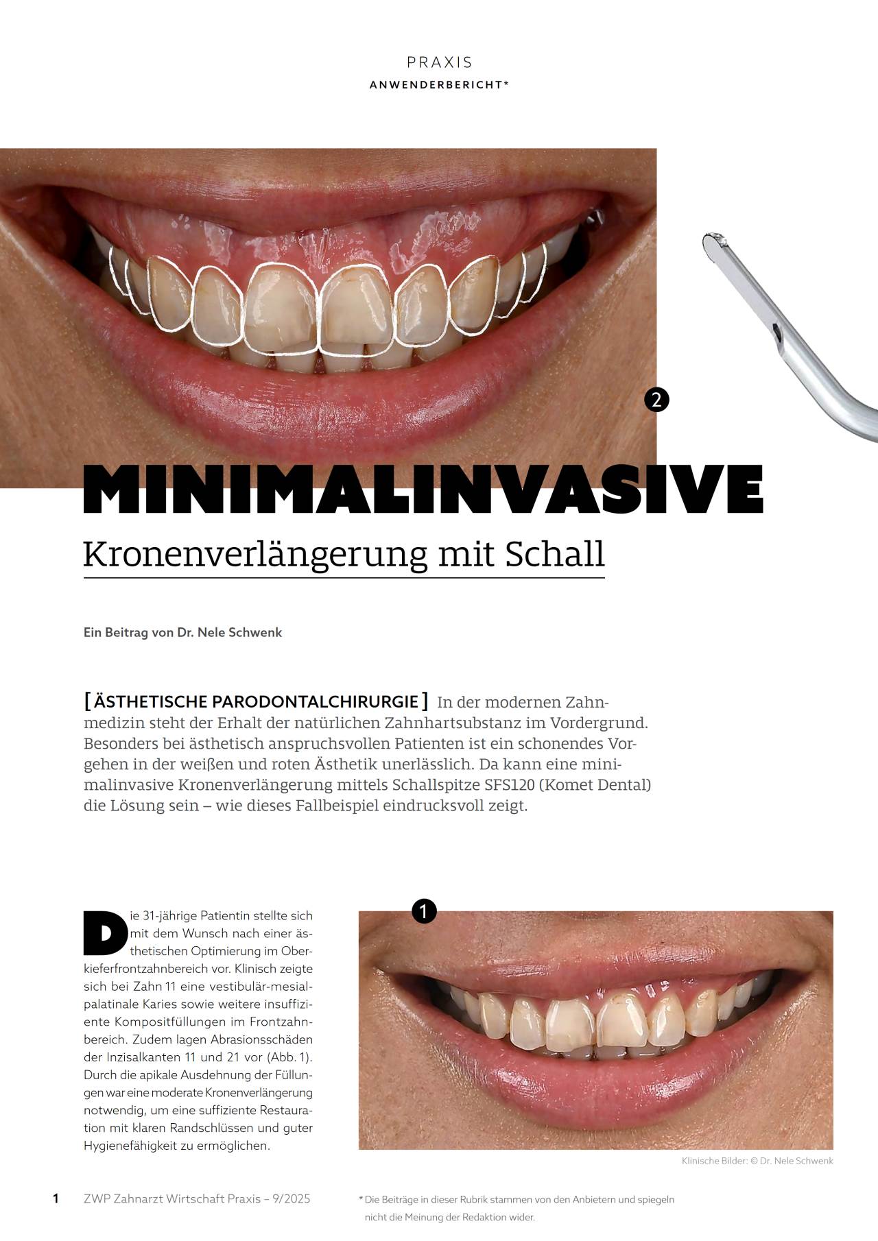 komet-dental-diao-komet-praxis-2025-09-fachartikel-schall image 1