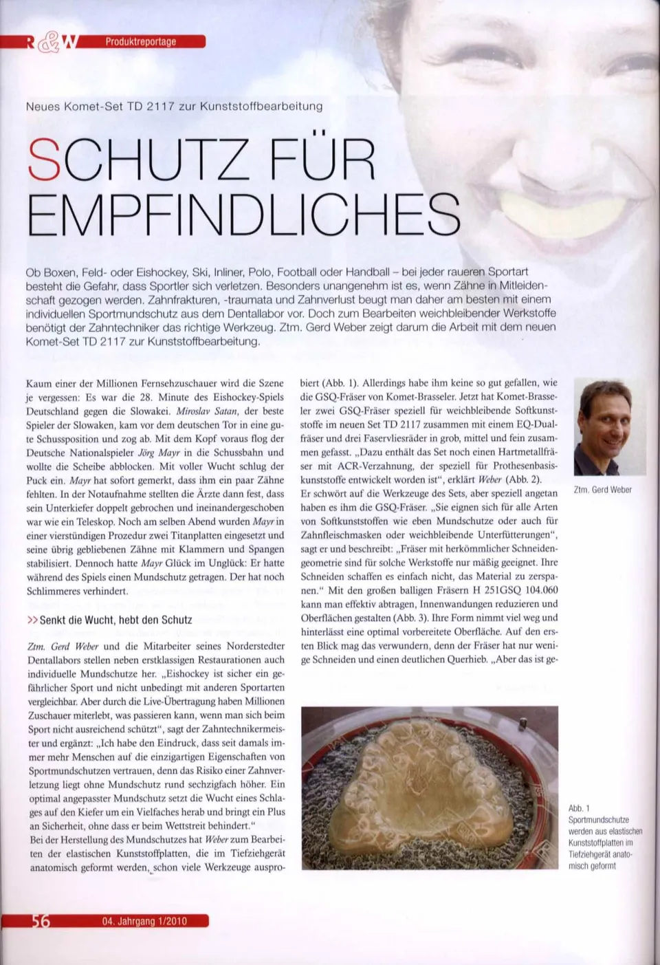 komet-dental-diao-fachbericht-td2117-kunststoffbearbeitung image 1