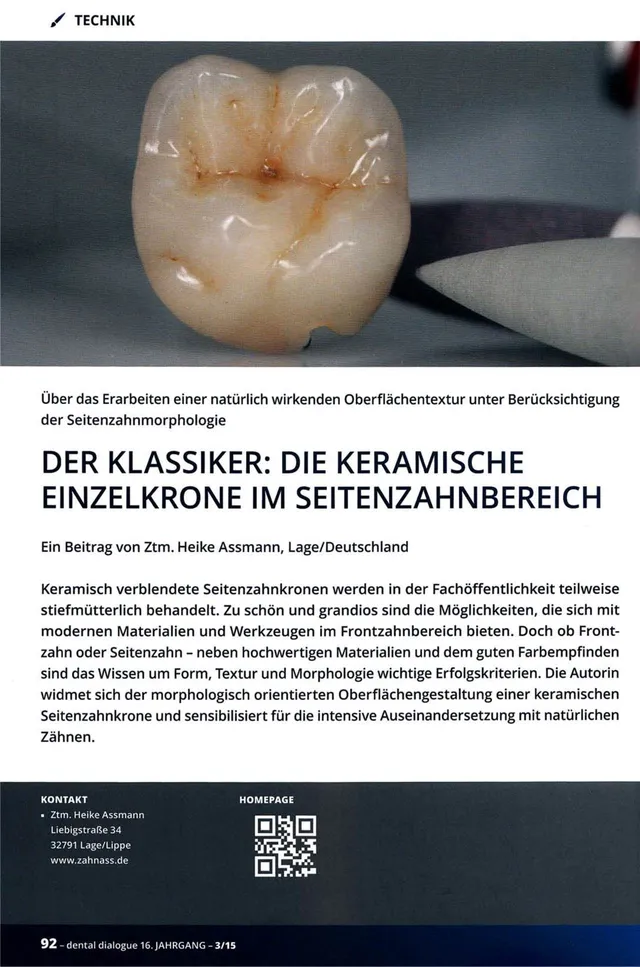 komet-dental-diao-fb-fachbericht-keramik-einzelkrone-seitenzahn image 1