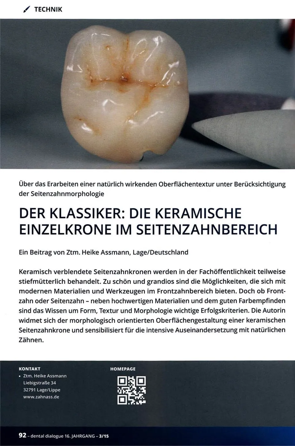 komet-dental-diao-fb-fachbericht-keramik-einzelkrone-seitenzahn image 1