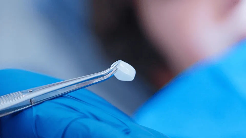 luxator-ceramir-pediatric-crowns-milchzahnkrone-f-r-kinder image 1
