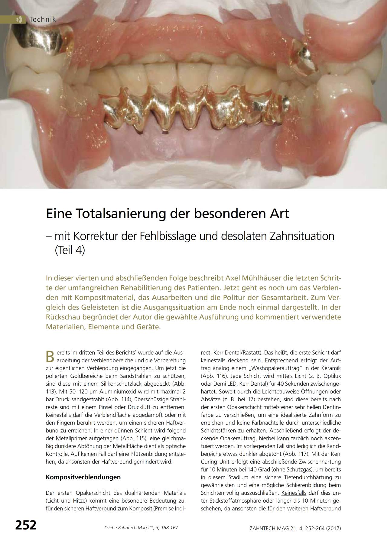komet-diao-fachbericht-totalsanierung-fehlbisslage-teil-4 image 1