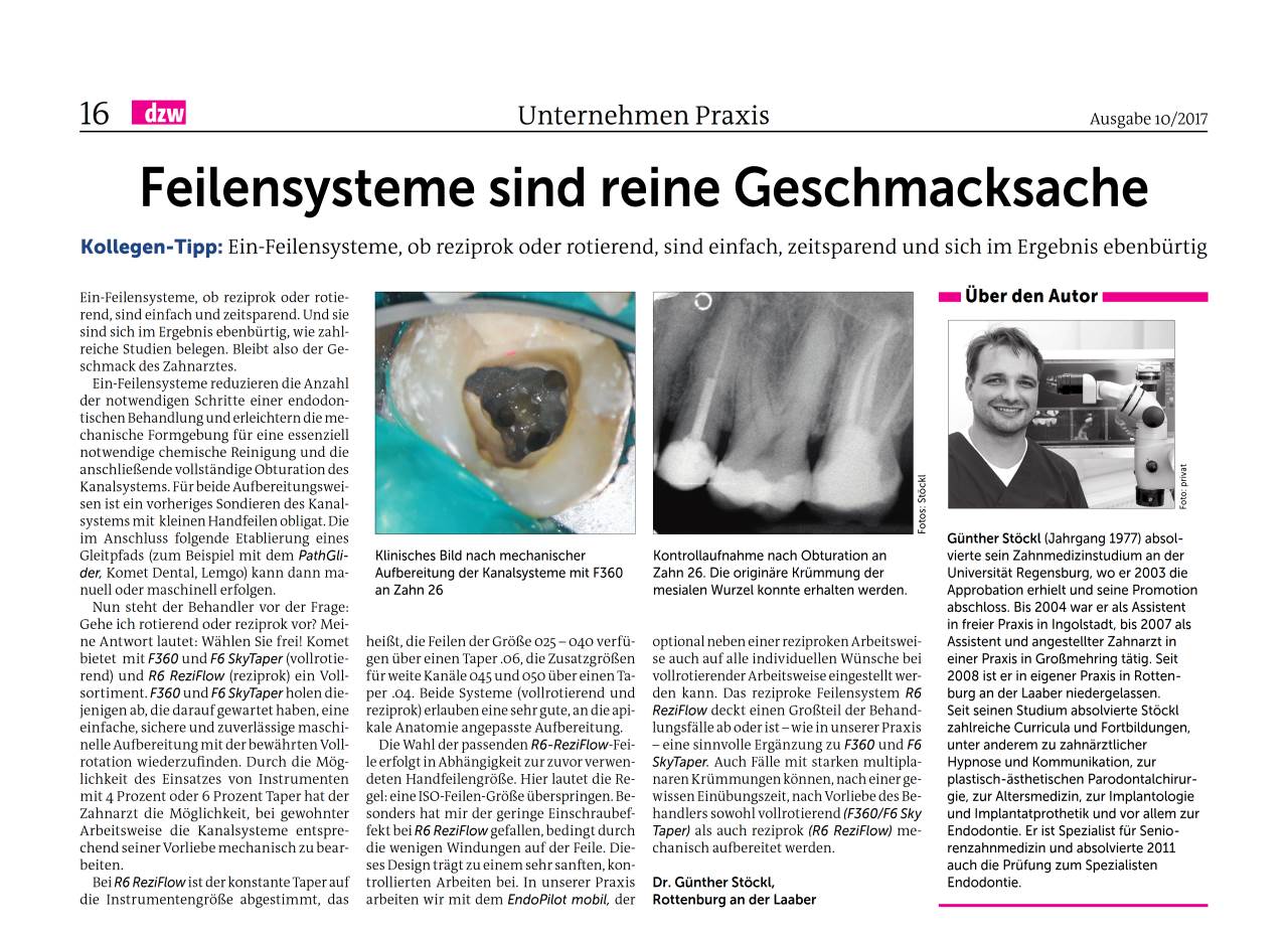 komet-dental-fq-wurzelkanalfeile-ein-feilensystem-reziprok image 1