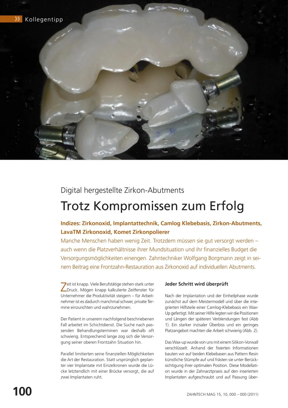 komet-dental-ceracut-fachbericht-zirkonoxid-bearbeitung-abutment image 1