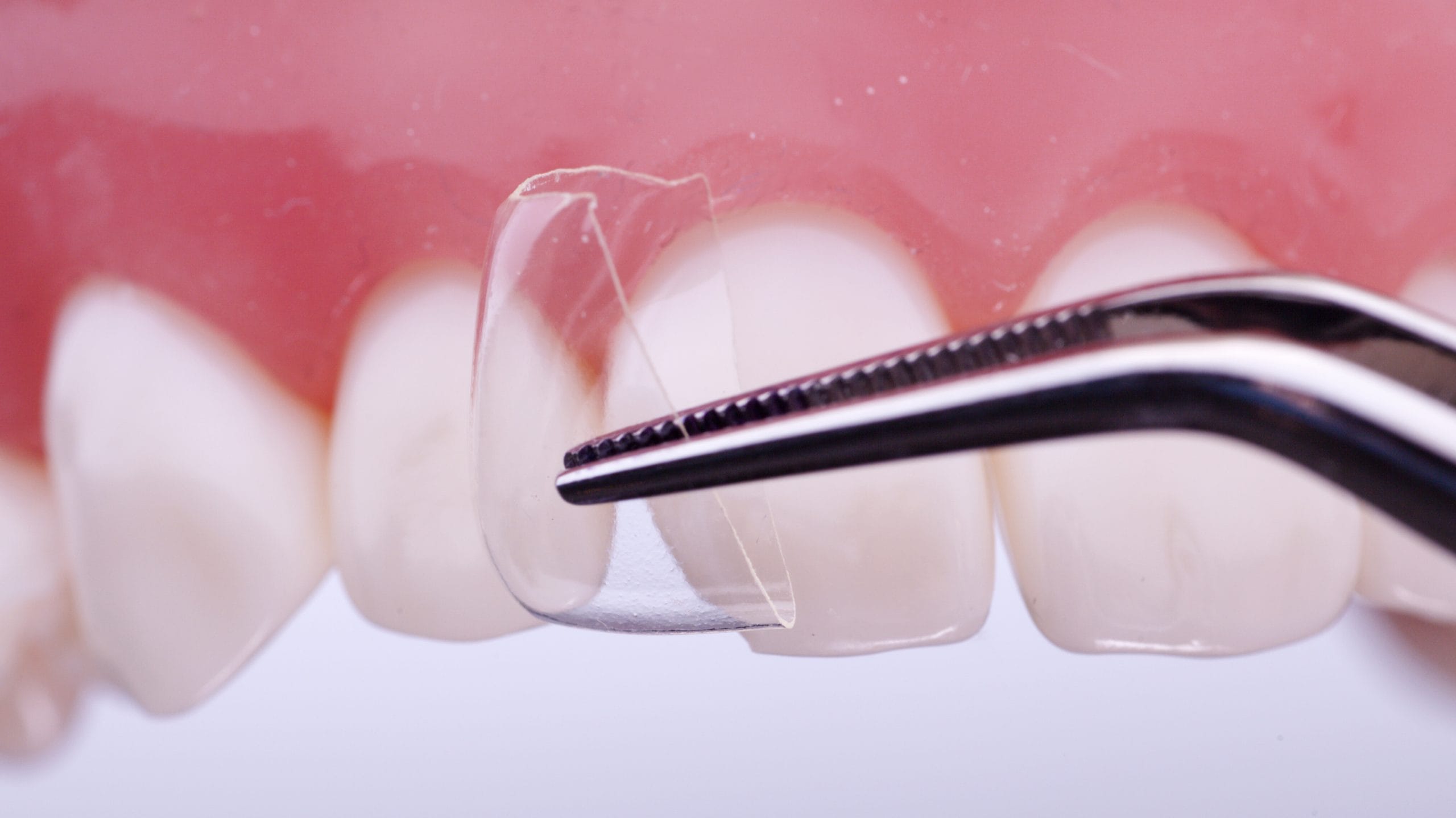 luxator-restorative-coform-matrize-komposit-klasse-iv-transparent image 1