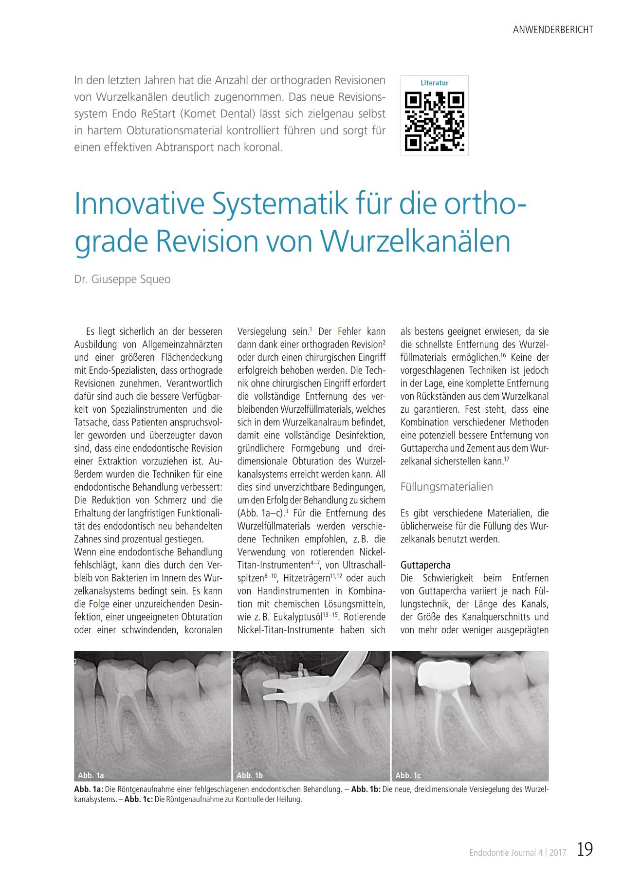 komet-dental-fq-fachbericht-orthograde-revision-wurzelkanal image 1