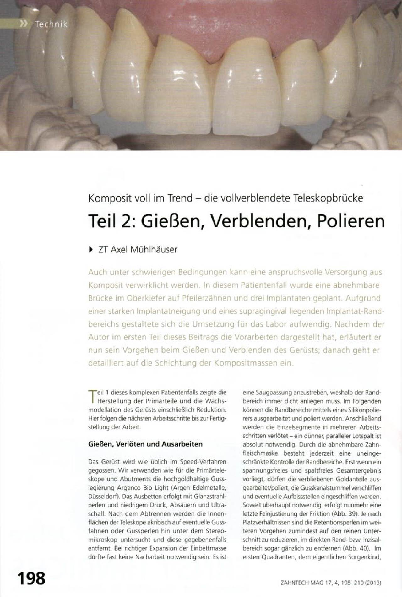 komet-dental-art2-fachbericht-gie-en-verblenden-polieren image 1