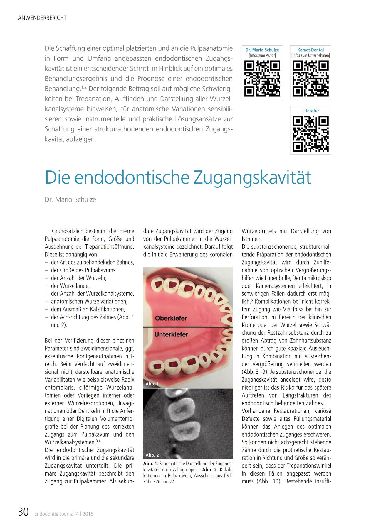 komet-fq-fachbericht-endodontische-zugangskavit-t-trepanation image 1