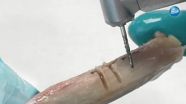 komet-ceradrill-h162st-knochenschneider-video-bone-cutter image 1