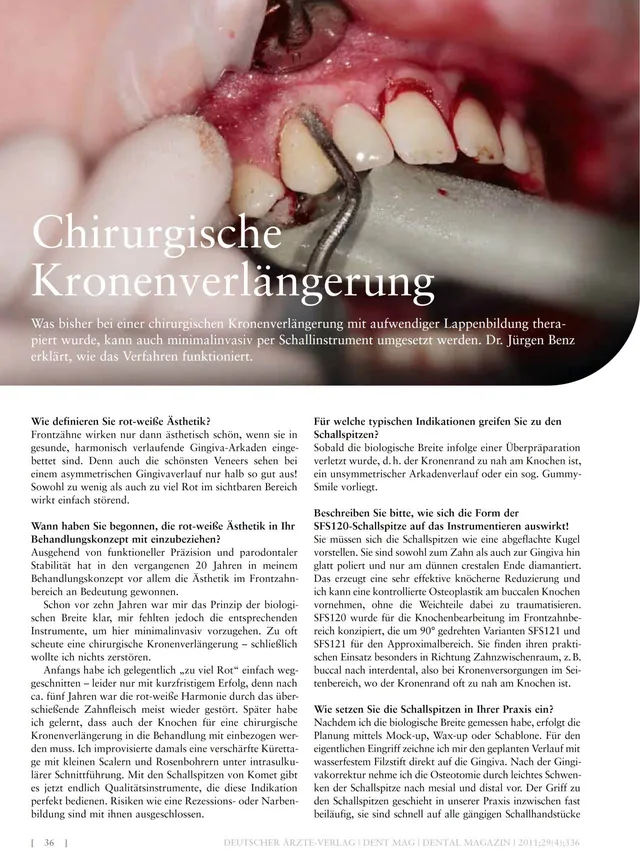 komet-ceradrill-kronenverl-ngerung-fachbericht-april-2011 image 1