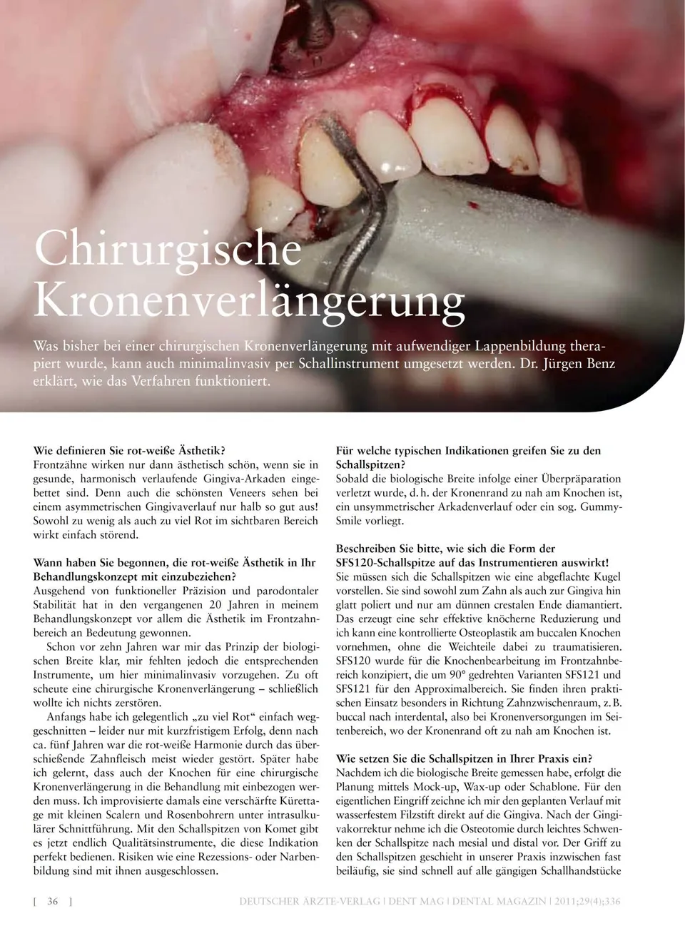 komet-ceradrill-kronenverl-ngerung-fachbericht-april-2011 image 1