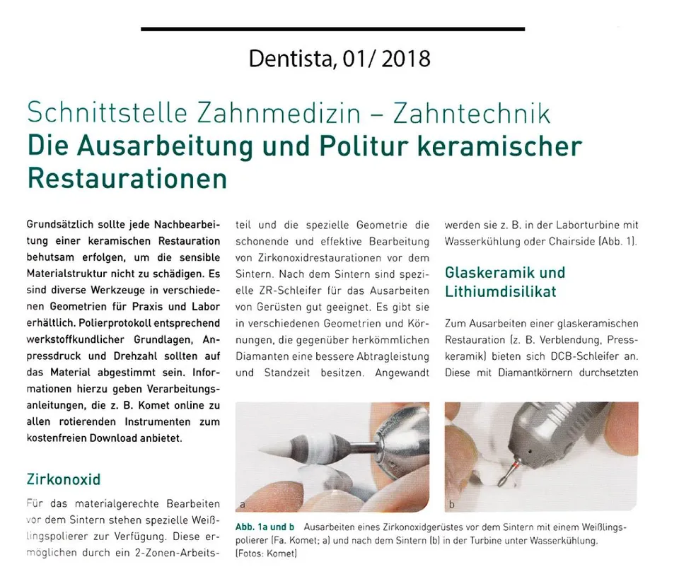 komet-shax-keramikpolitur-fachbericht-schnittstelle-zahntechnik image 1
