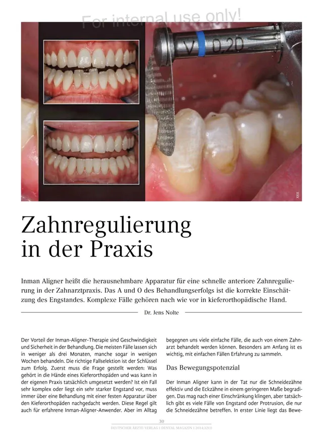 komet-diao-fachbericht-zahnregulierung-inman-aligner-praxis image 1