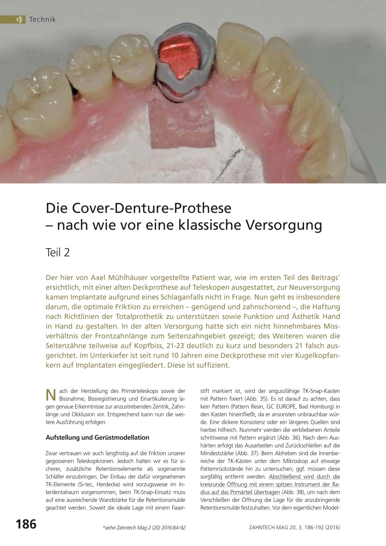 komet-dental-shax-laborfr-ser-cover-denture-prothese-set image 1