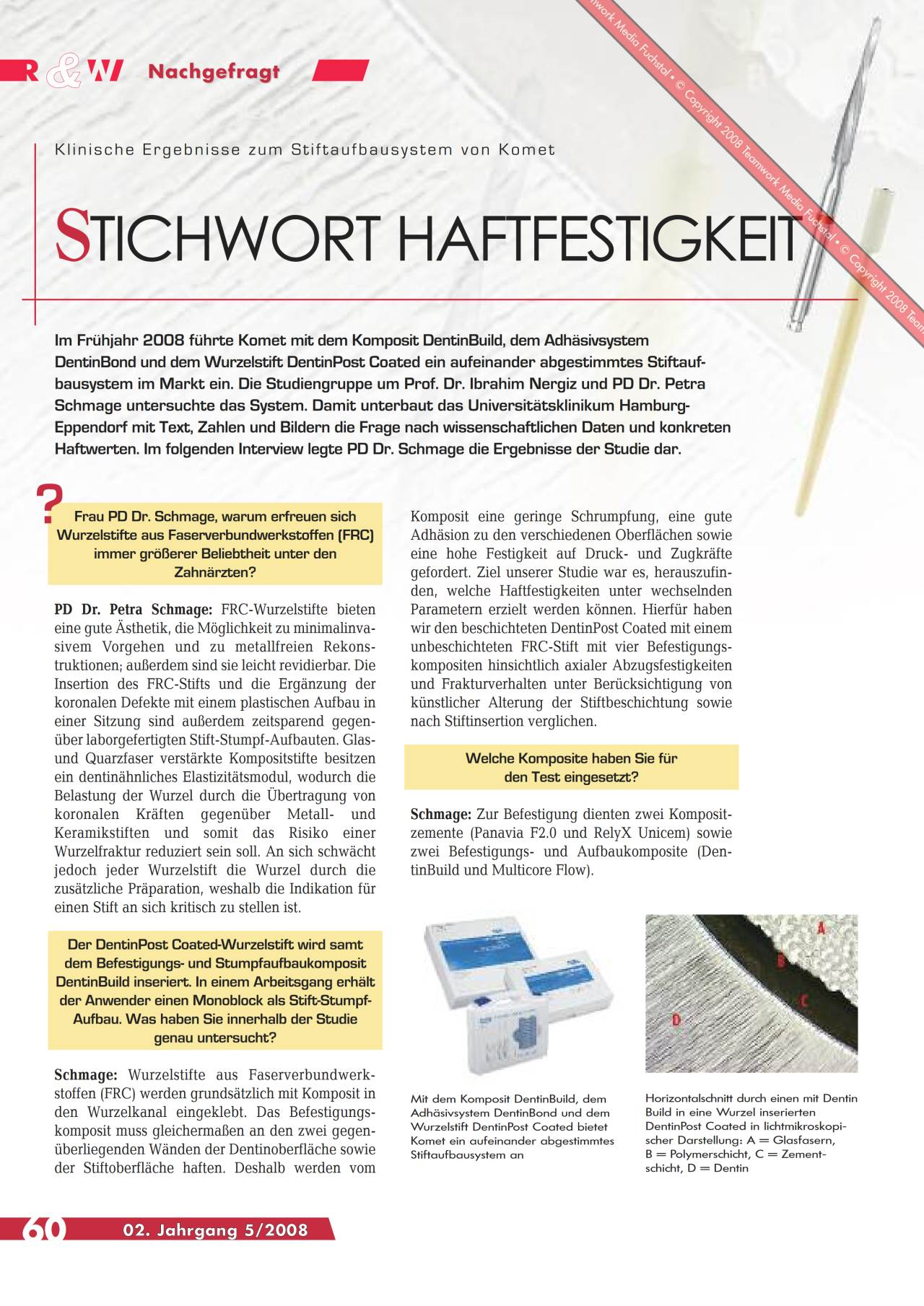 komet-ceracut-fachbericht-composite-stiftaufbau image 1